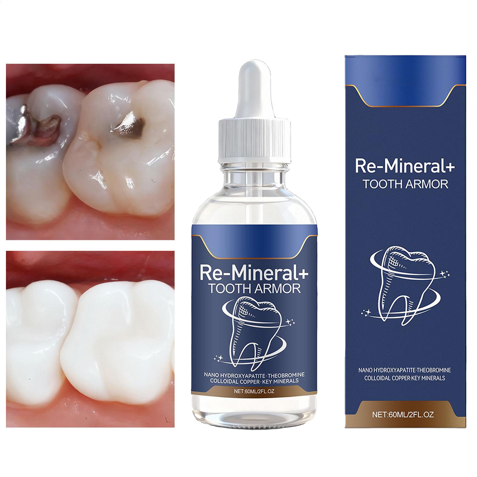 Teeth Whitening Gum - 60 ml Zahnreinigungsflüssigkeit entfernt Zahnflecken, Zahnweißung,