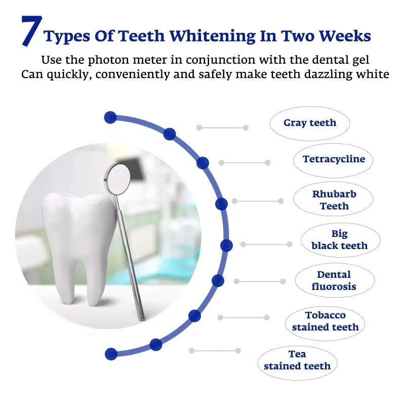 Intelligente LED-Blaulichtlamp – Teeth Whitening Gum Bewertung und Preis