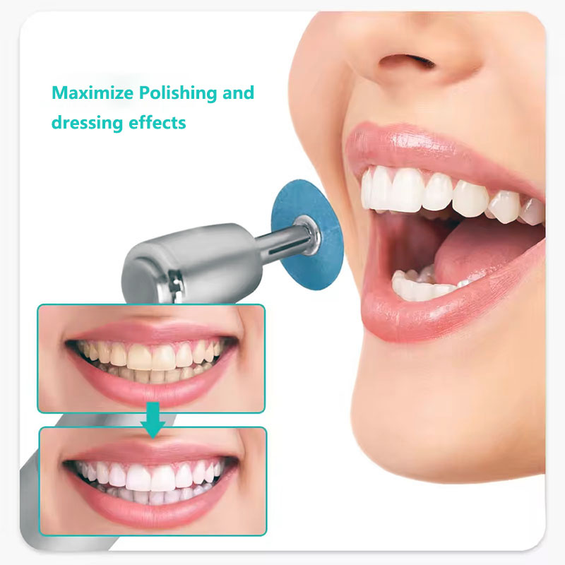 40 stücke Dental Polieren Sche – Teeth Whitening Home Bewertung und Preis